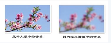 健康四川 光明“视”界—爱尔眼科大型眼健康救治行动开启